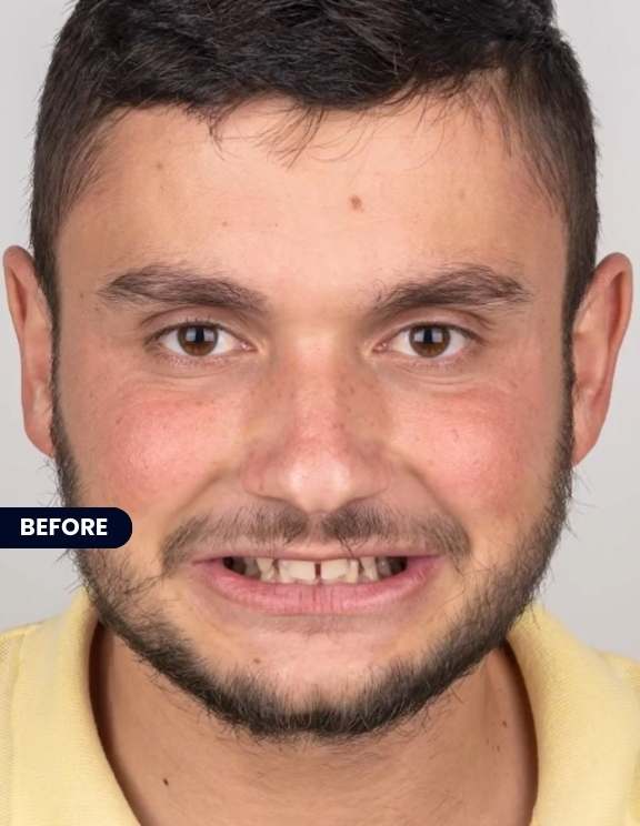 "Before: The Journey to a Brighter Smile Begins