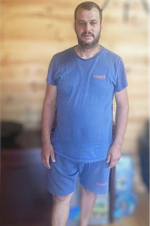 A man after His weight Loss Treatment in Turkey